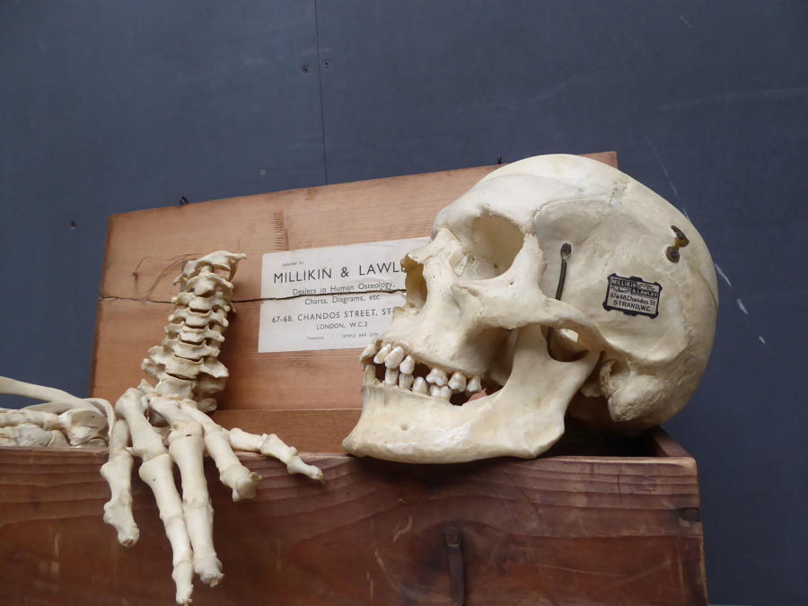 Human Half Medical Skeleton By Millikin & Lawley
