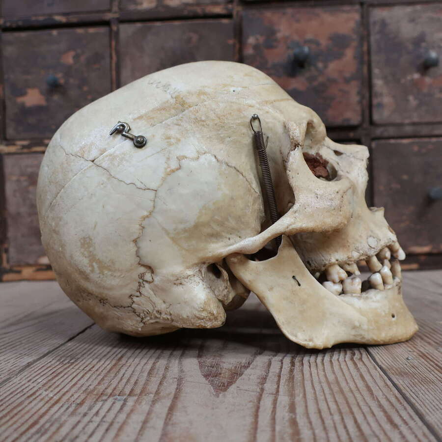 Birmingham University Human Medical Skull