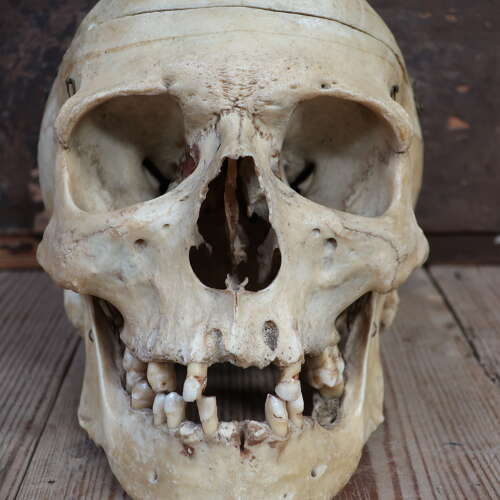 Birmingham University Human Medical Skull